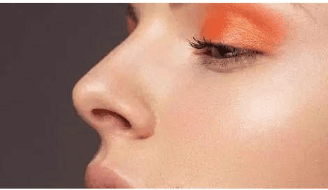 隆鼻手術(shù)多久恢復(fù)自然?