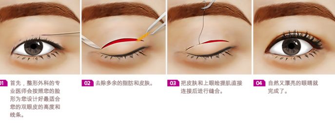 �p��Ƥ�g��Ҫ��û֏���