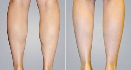 ���ͺ�����Ч�Ĝp�ʷ�����ʲô��