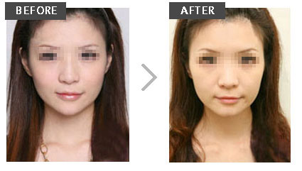 ���ͺ������w֬���S̫�Ѩ�r��