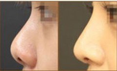 ���ͺ���ע��¡�ǵ�Ч���ܾS�ֶ��