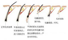 ���ͺ��ر��c(di��n)����Óë �ҷ���(l��i)�u