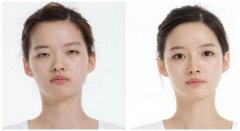 ����������ǰ�A(y��)�� �߿����������ݴ�܊