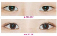 ���ͺ����p��ƤЧ�������ӵģ�