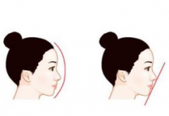 ���ͺ����в�����¡�Ǻ��ܿ�����(l��i)��?