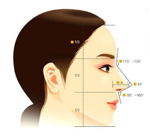 假體隆鼻后恢復要多久