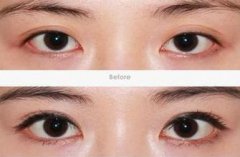 ���ͺ������_�۽Ƕ����X