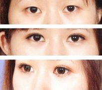 ���ͺ������p��Ƥ�Ƿ�ÿ��(g��)�˶��m����