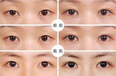 ���ͺ��؏����F����ȫ���B�񾀷��ز��g(sh��)