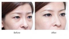 ���ͺ��������۴����g(sh��)�п��ܰl(f��)�����z�Y��?