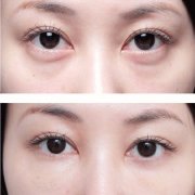 ���ͺ�������Щ�˲��������۴����g(sh��)?