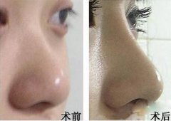 ���ͺ�����¡���ޏͰ�ȫ�������