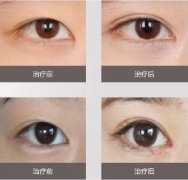 ���ͺ������nʽ�p��Ƥ �����۾����@�_ʼ