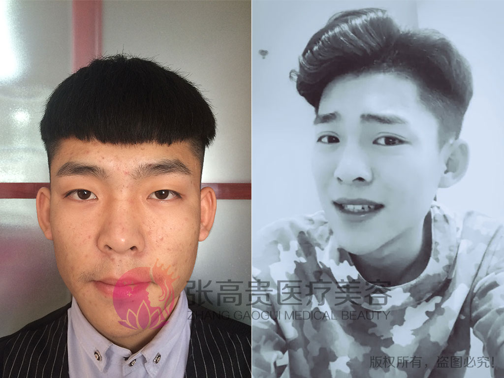 ���p��Ƥ���ȈD