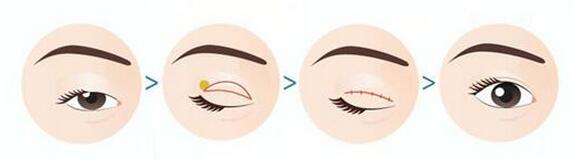 ���ͺ��؏����F����