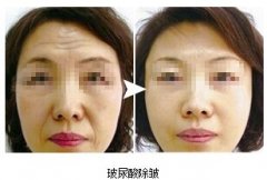 ���ͺ�����ע�䲣�������ᘕ�������