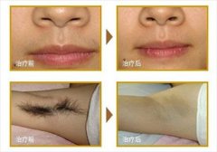 ���ͺ����б��c(di��n)����Óë�ăr(ji��)���Ƕ�����