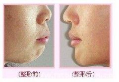 ���ͺ��������g�t(y��)Ժ���°����α��^����