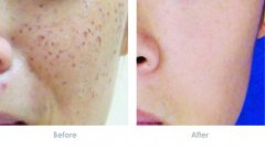 ���ͺ������ļ��t(y��)Ժ�ʹ����wЧ����