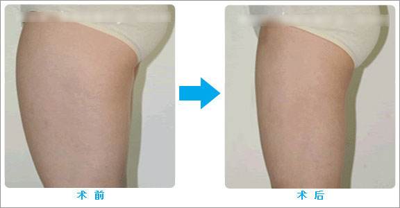 ���ͺ�������