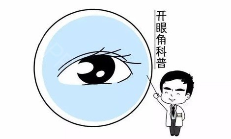 呼和浩特整形醫(yī)院開眼角