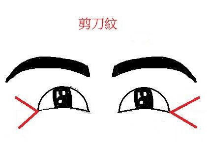 呼和浩特整形醫(yī)院祛除魚尾紋的方法