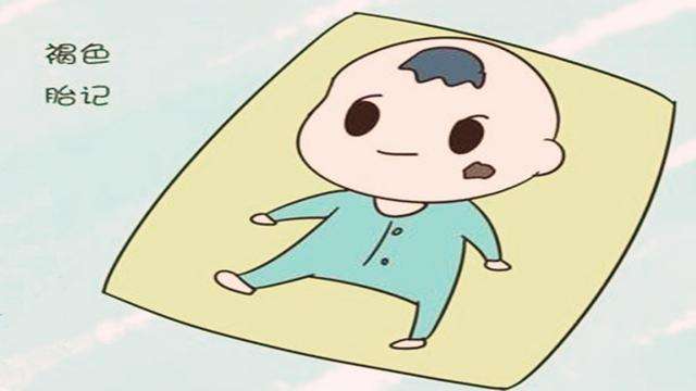 治療胎記激光好還是皮秒好?