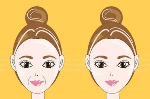 呼和浩特整形自體脂肪填充蘋果肌效果明顯嗎?