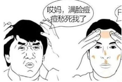 激光祛痘印會(huì)留坑嗎?