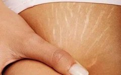 ��������ּy��õķ�����ʲô��