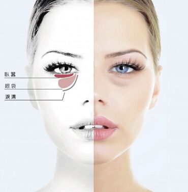 祛除眼袋有哪些副作用呢