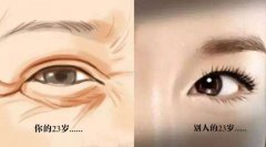 ����~β�y����Ҫע��Щʲô����