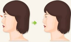 ���ͺ��������t(y��)Ժע��¡���F���F��