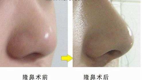 ���ͺ��������t(y��)Ժ���w¡�Ƕ����X��