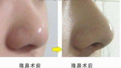 ���ͺ��������t(y��)Ժ���w¡�Ƕ����X��?