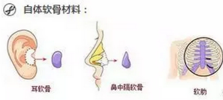 ���ͺ��������t(y��)Ժ���w¡����ʲô��(y��u)����