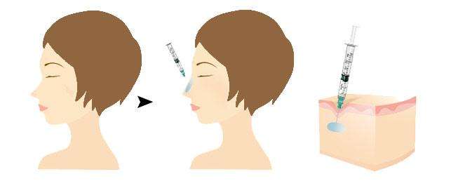 ���ͺ��������t(y��)Ժ¡������Щ�L(f��ng)�U��