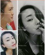 ���ͺ��������t(y��)Ժ���w¡���܉�S�ֶ��L(zh��ng)�r(sh��)�g����