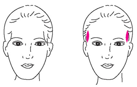 呼和浩特整形醫(yī)院玻尿酸豐太陽(yáng)穴效果怎么樣