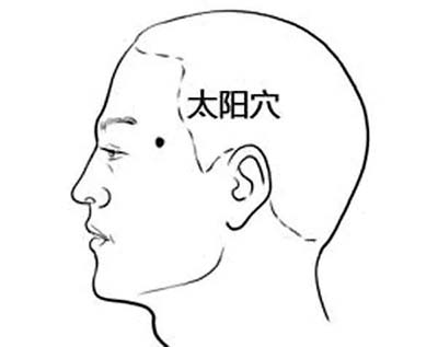 填充太陽穴的方法有哪些
