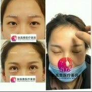 ���ͺ����p��Ƥ�g(sh��)����ô�o(h��)������