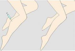 ���ͺ��������t(y��)Ժ�Ȳ���֬��ȫ����