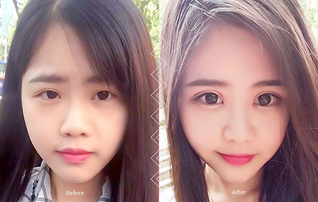 呼和浩特眼部整形有哪些整形項(xiàng)目呢