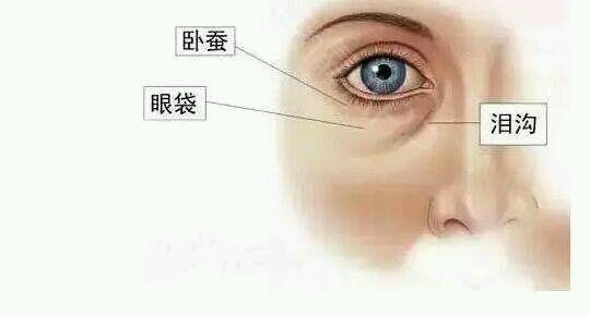 呼和浩特眼部整形眼袋和臥蠶有哪些區(qū)別呢