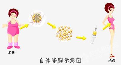 ���ͺ��������t(y��)Ժ���w֬��¡��Ч����ô��