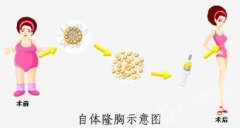 ���ͺ��������t(y��)Ժ���w֬��¡��Ч����ô����