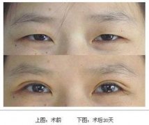 ���ͺ����p��Ƥ���θ��p��Ƥ��߀���񾀺���?