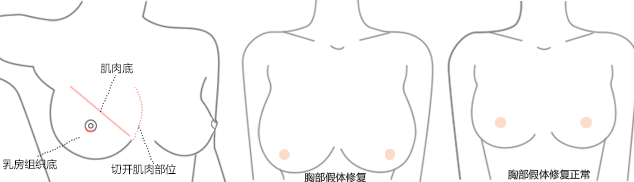 �����ز�����¡��ʧ����ô�k��