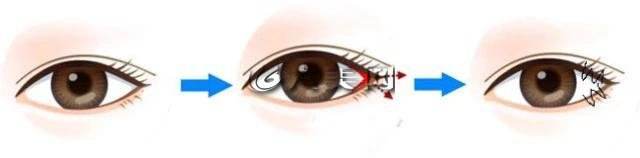 ���������_�۽��m�ϵ�������Щ�����m�ϵ�����Щ