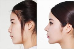 ���ͺ�������ע��¡�Ǻ�߀�Ǽ��w¡�Ǻ�